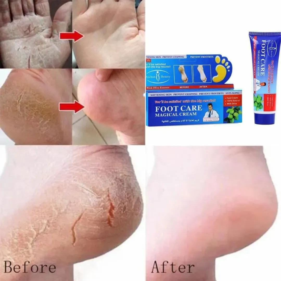 Crème magique pour pieds – Soin nourrissant et hydratation intense pour une peau douce