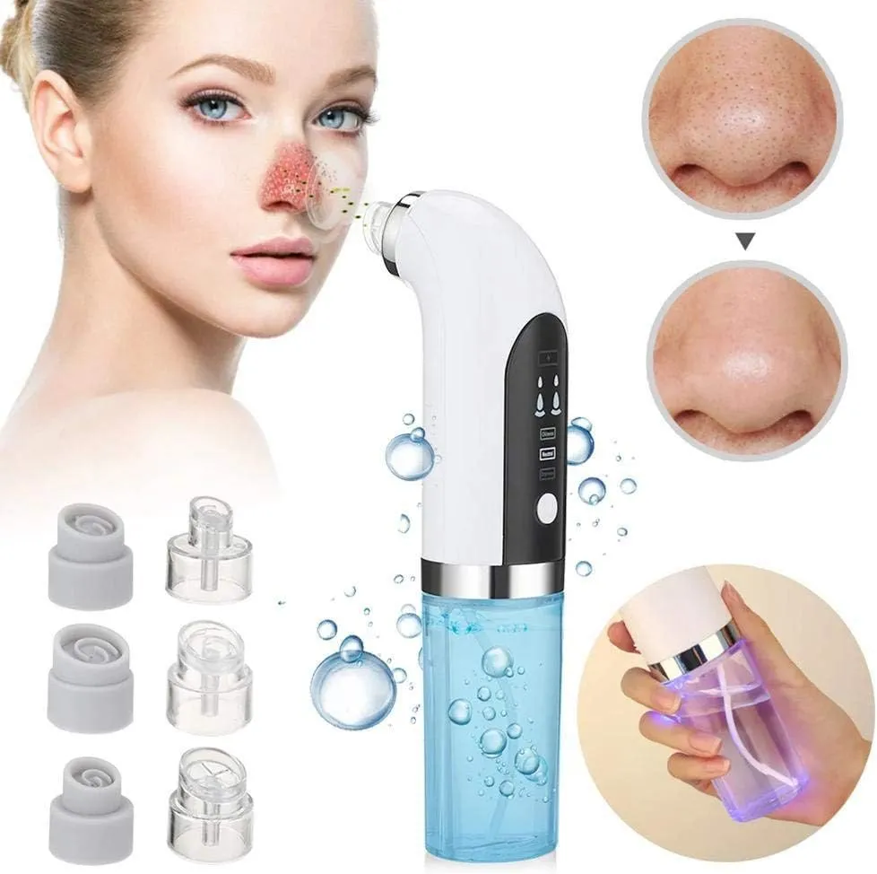 Aspirateur de points noirs avec 6 embouts, dissolvant de comédons et nettoyant facial