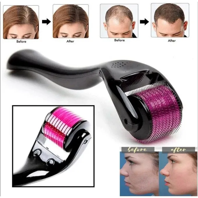 Boostez votre barbe avec notre Roller Rouleau à Micro aiguilles pour une peau et une repousse capillaire optimales