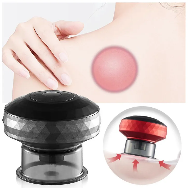 masseur-electrique-topique-pour-ventouses-cutanees ( couleur aléatoire)